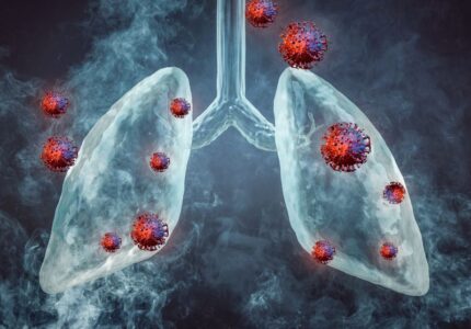 Allergic Bronchitis ( एलर्जी जनित श्वसनी शोथ)