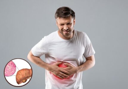 Fatty Liver (फैटी लिवर)